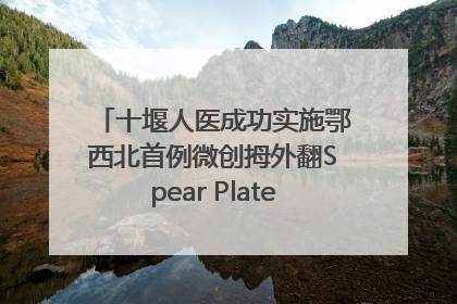 十堰人医成功实施鄂西北首例微创拇外翻Spear Plate髓内板矫形术